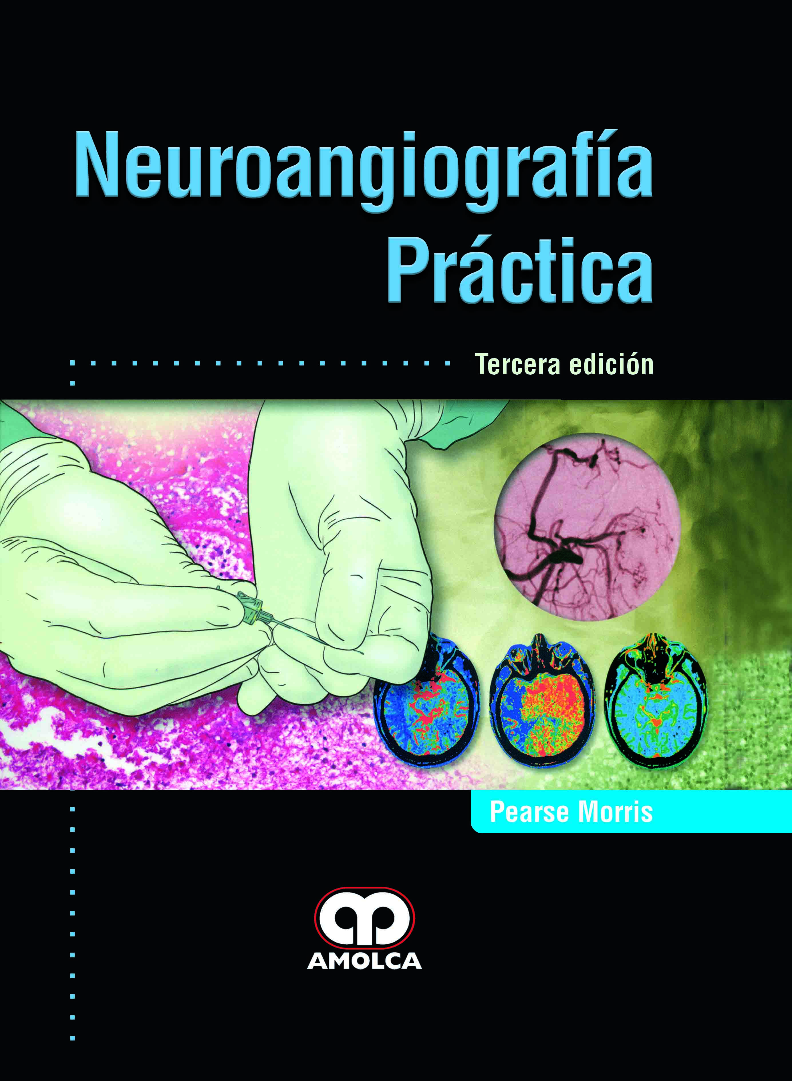 NEUROANGIOGRAFÍA PRÁCTICA