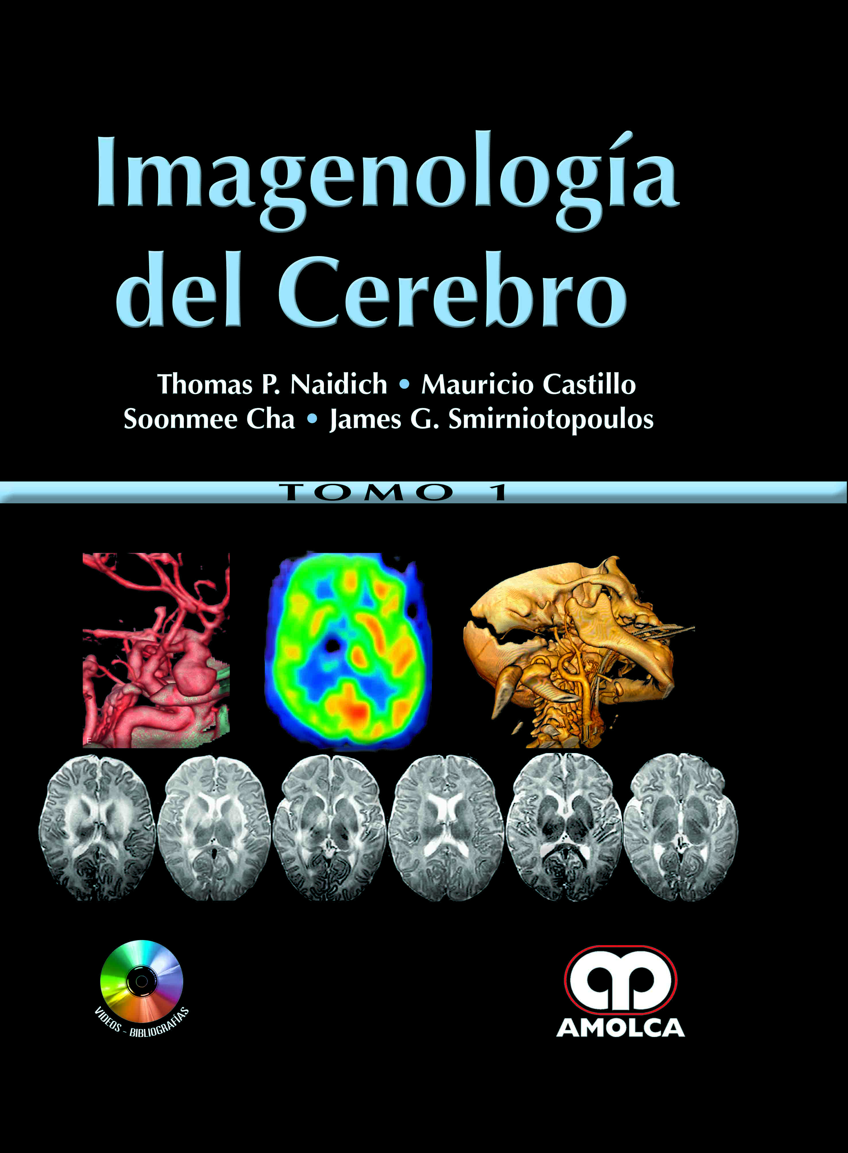 IMAGENOLOGÍA DEL CEREBRO. 2 Vols.