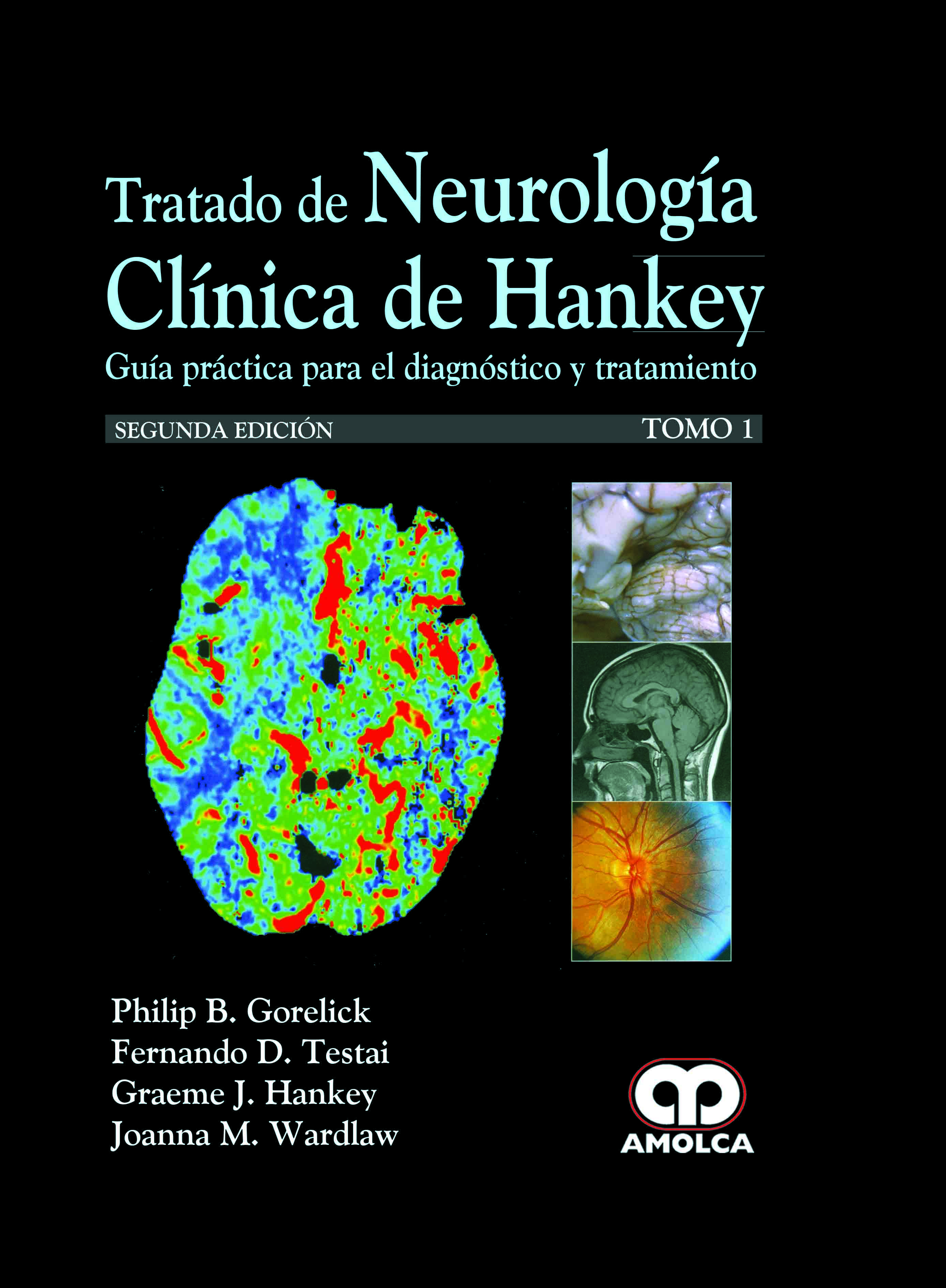 TRATADO DE NEUROLOGÍA CLÍNICA DE HANKEY. 2 Tomos