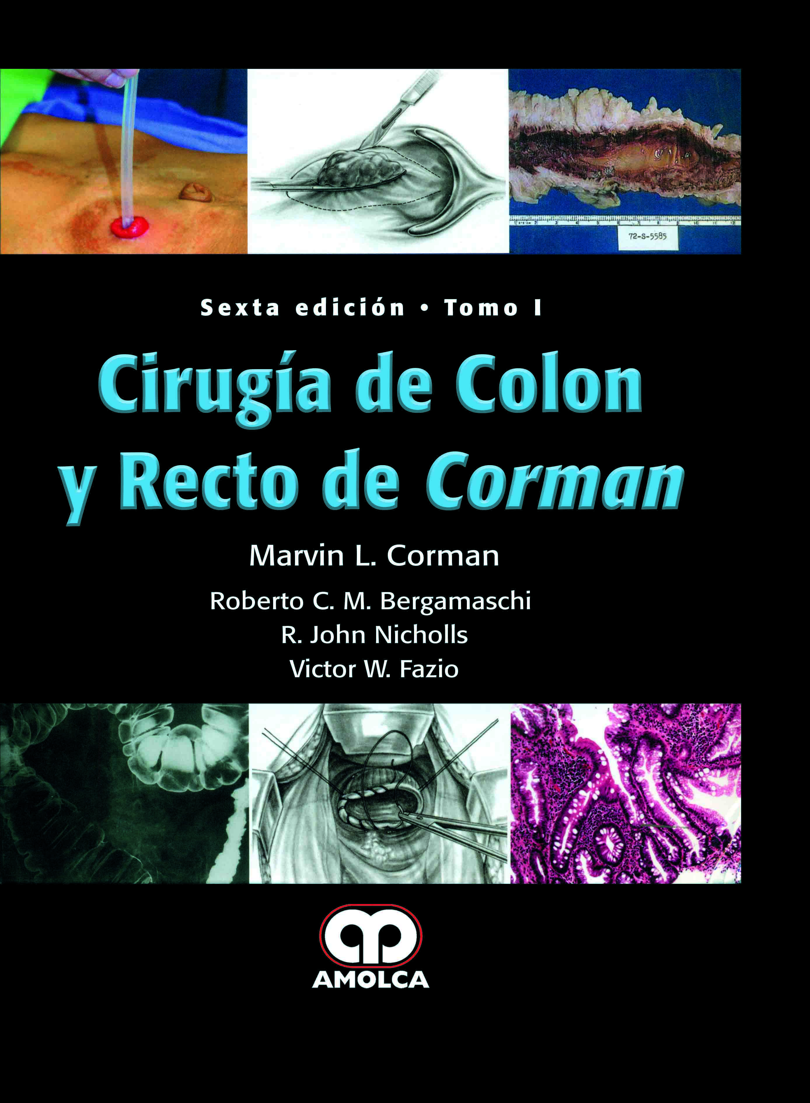 CIRUGÍA DE COLON Y RECTO DE CORMAN