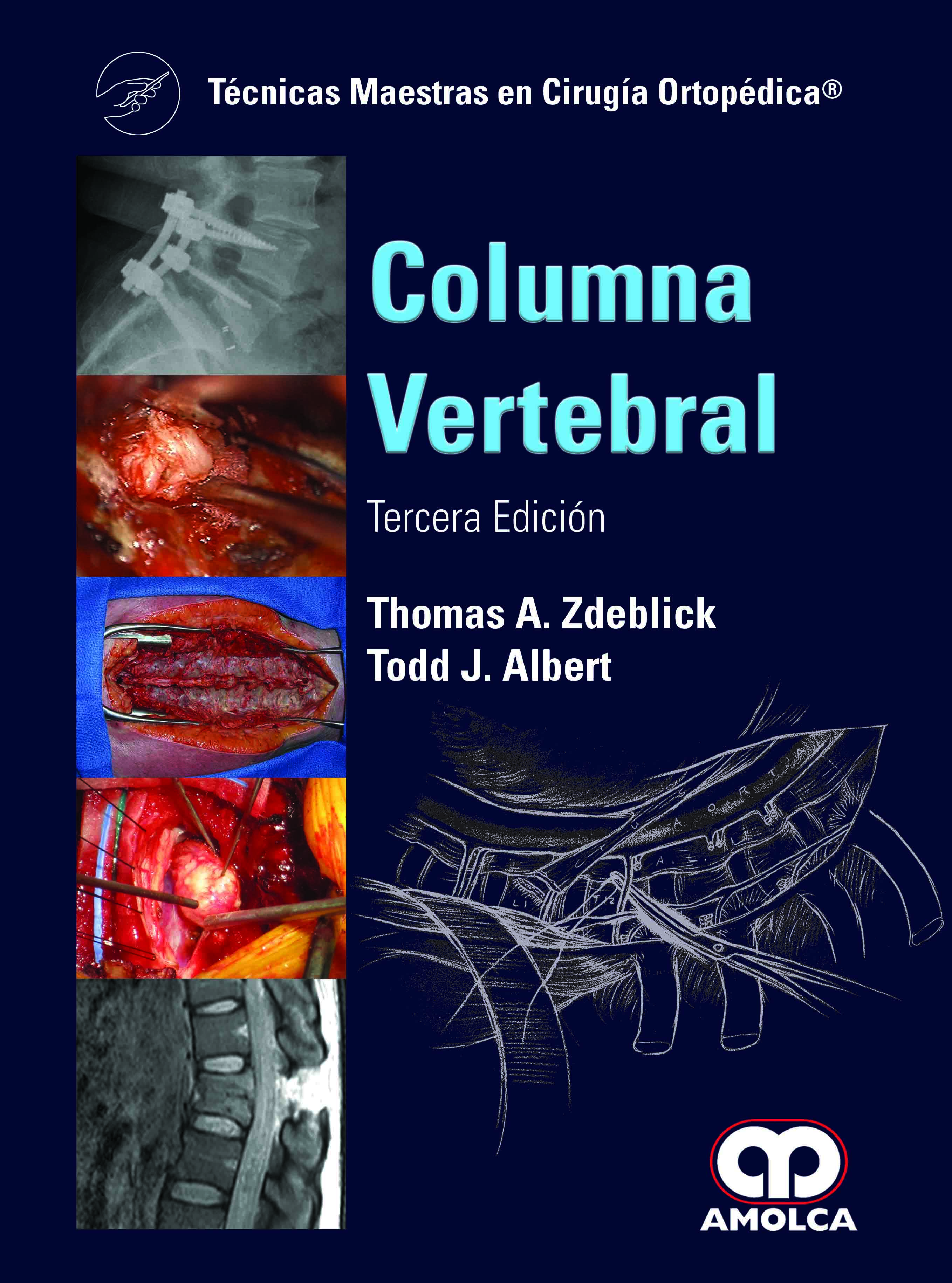 COLUMNA VERTEBRAL. TÉCNICAS MAESTRAS