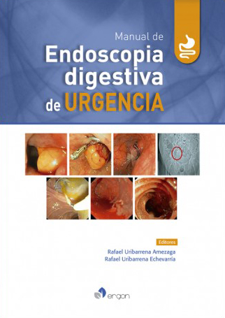 Manual de endoscopia digestiva de Urgencia