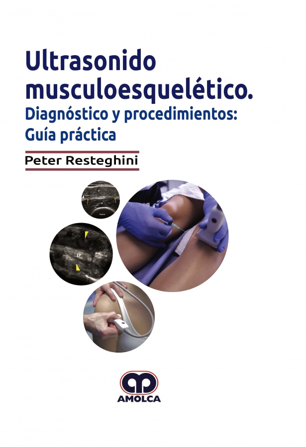 Ultrasonido Musculoesquelético