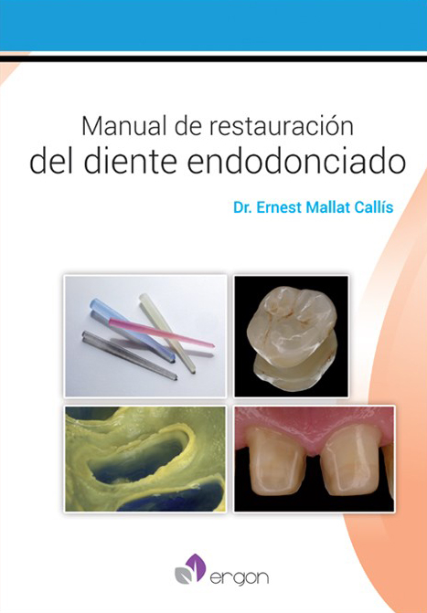 Manual de Restauración del Diente Endodonciado