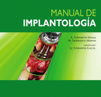 Manual de Implantología