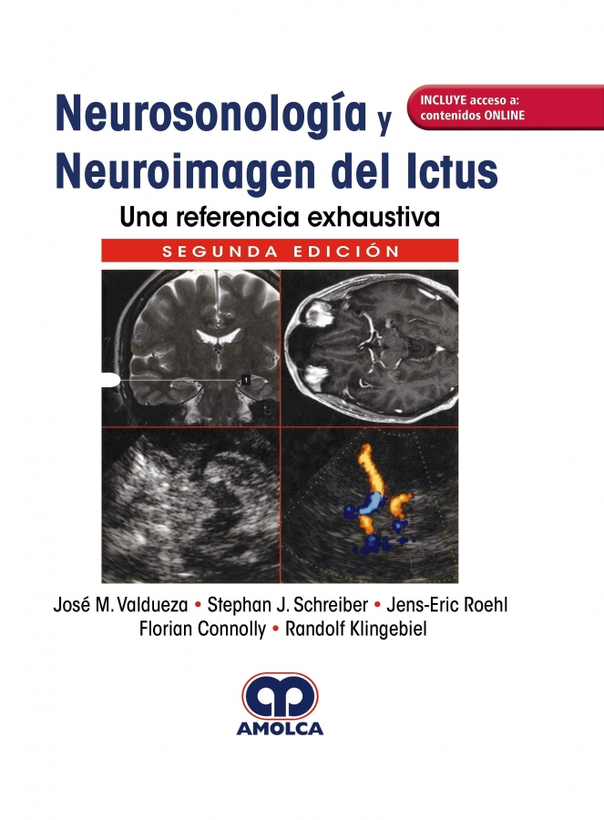 Neurosonología y Neuroimagen ICTUS