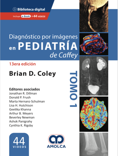 DIAGNOSTICO IMAGENOLOGICO PEDIATRICO DE CAFFEY 13 ED