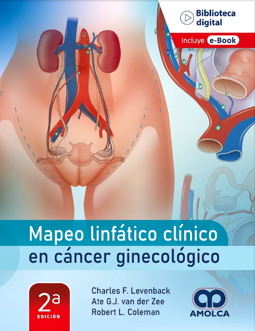 MAPEO LINFATICO EN CANCER GINECOLOGICO