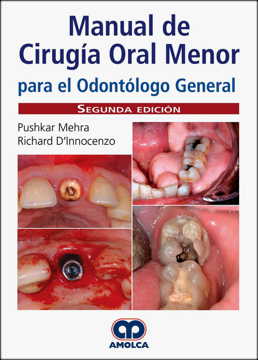 MANUAL DE CIRUGIA ORAL MENOR PARA EL ODONTOLOGO GENERAL