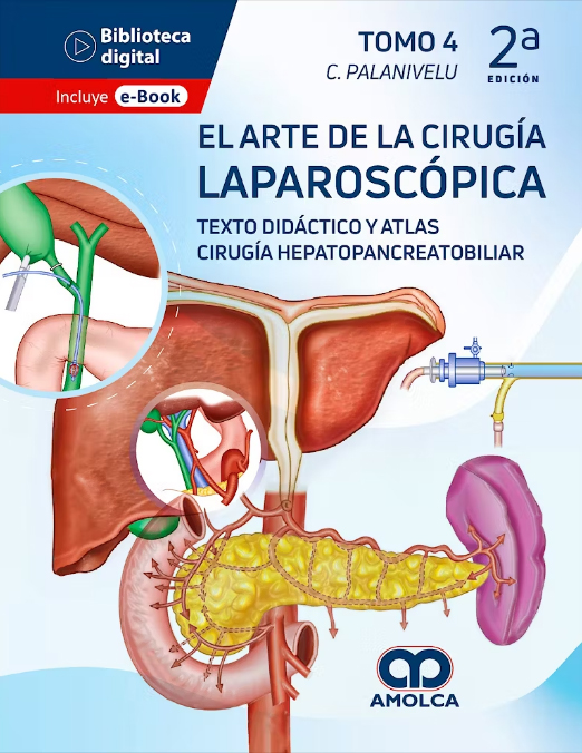 El Arte de la Cirugía Laparoscópica Tomo 4: Texto Didáctico y Atlas. Cirugía Hepatopancreatobiliar