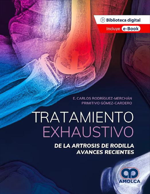 Tratamiento Exhaustivo de la Artrosis de Rodilla. Avances Recientes