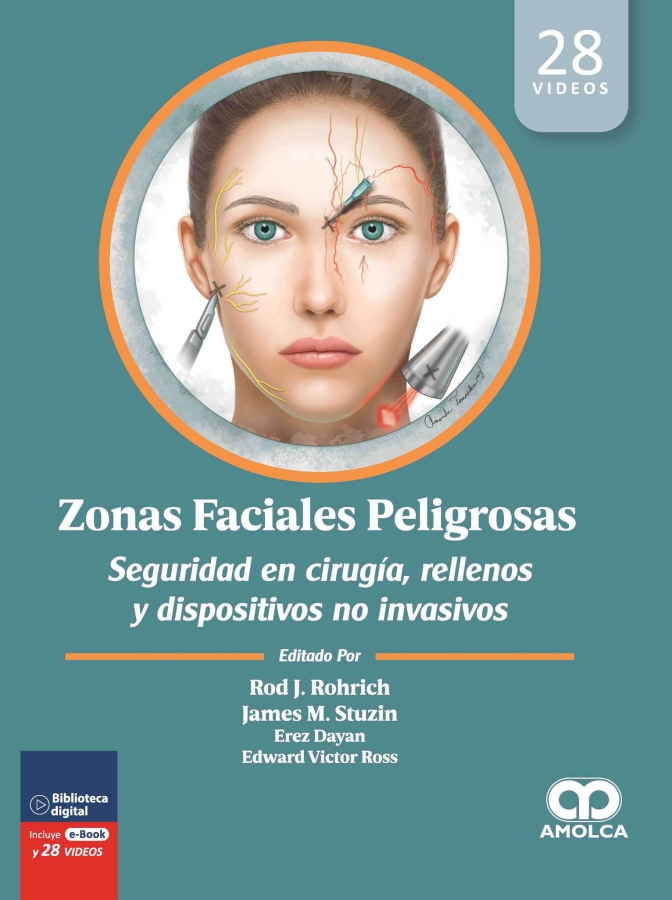 ZONAS FACIALES PELIGROSAS