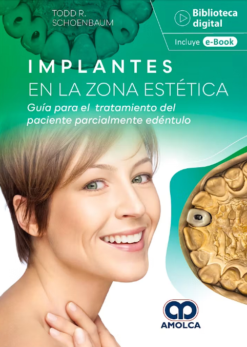 Implantes en la Zona Estetica. Guia para el Tratamiento del Paciente Parcialmente Edentulo