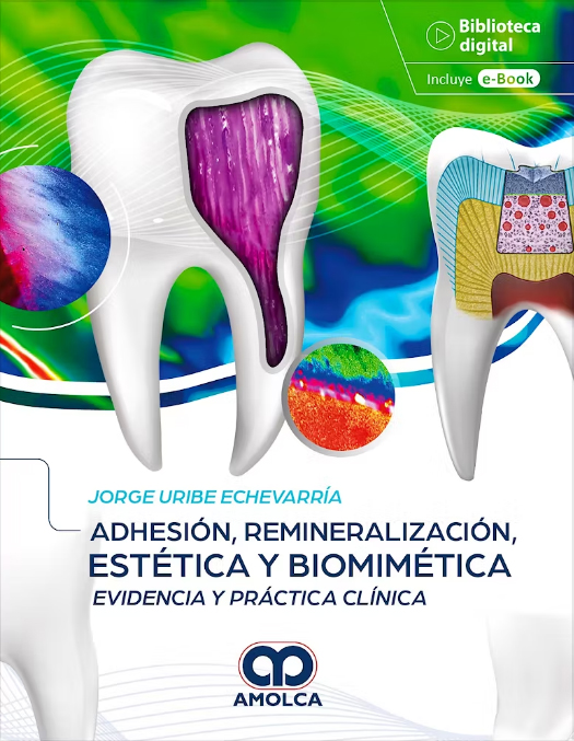 ADHESION REMINERALIZACION ESTETICA Y BIOMIMETICA