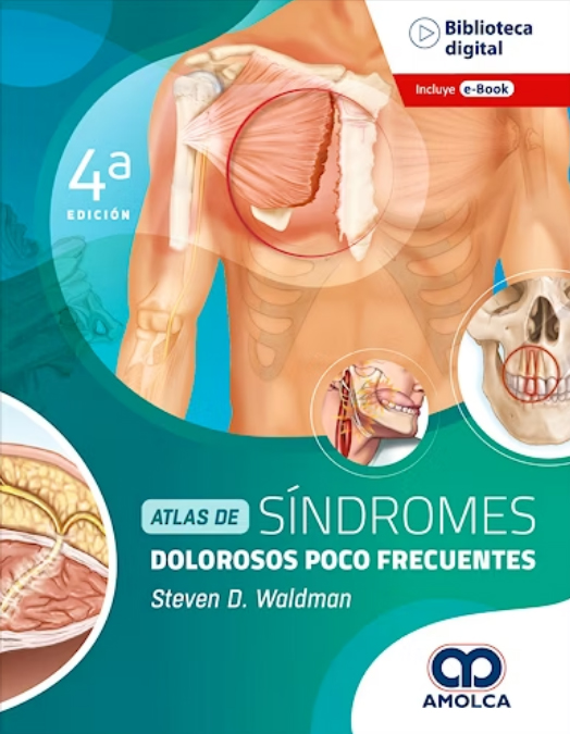 ATLAS DE SINDROMES DOLOROSOS POCO FRECUENTES 4 ED