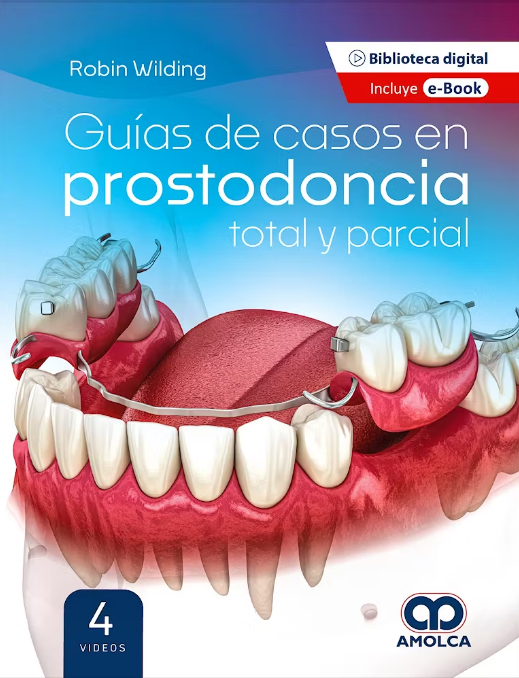 Guias de Casos en Prostodoncia Total y Parcial