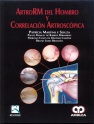ARTRORM DEL HOMBRO Y CORRELACION ARTROSCOPICA