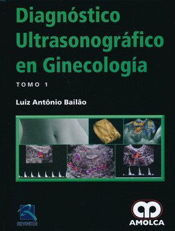Diagnóstico Ultrasonográfico en Ginecología
