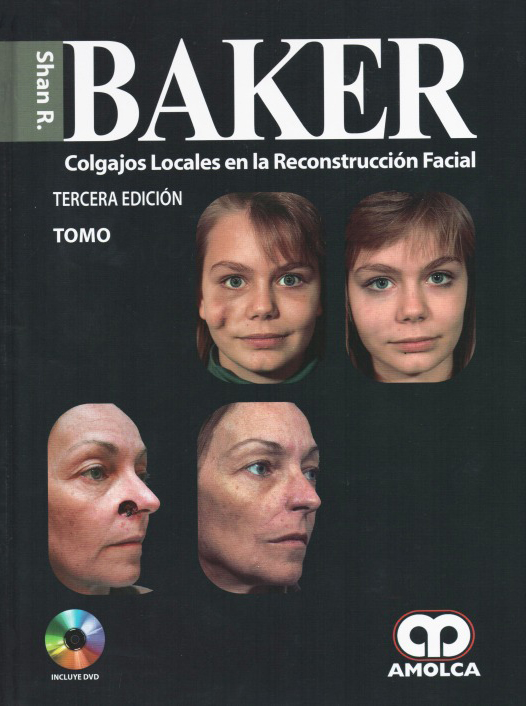 BAKER COLGAJOS LOCALES EN LA RECONSTRUCCION FACIAL