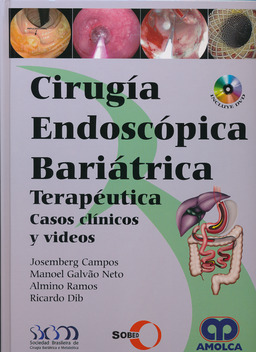 CIRUGIA ENDOSCOPICA BARIATRICA TERAPEUTICA. CASOS CLINICOS Y VIDEOS
