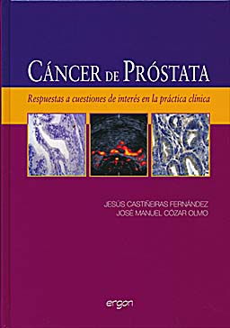 CANCER DE PROSTATA. RESPUESTAS A CUESTIONES DE INTERES EN LA PRACTICA CLINICA
