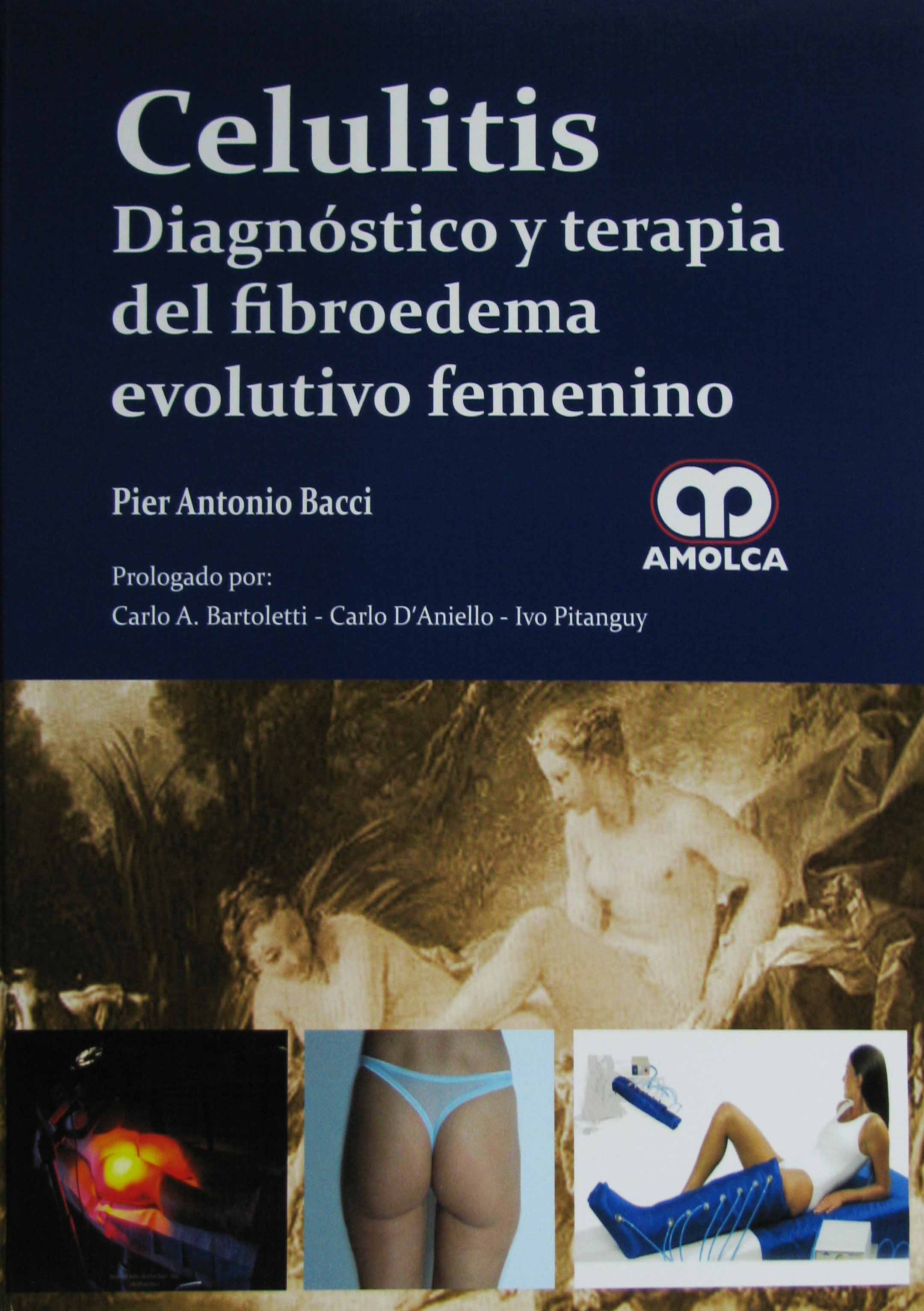 CELULITIS DIAGNOSTICO Y TERAPIA DE FIBROEDEMA EVOLUTIVO FEMENINO