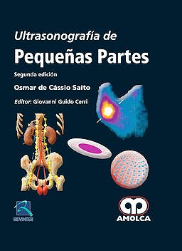 Ultrasonografía de Pequeñas Partes