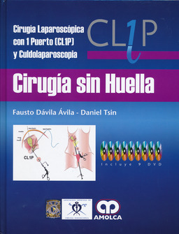 CIRUGIA SIN HUELLA - CULDOLAPAROSCOPIA 9 DVD CIRUGIA LAPAROSCOPICA CON 1 PUERTO (CL1P)
