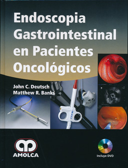 ENDOSCOPIA GASTROINTESTINAL EN PACIENTES ONCOLOGICOS