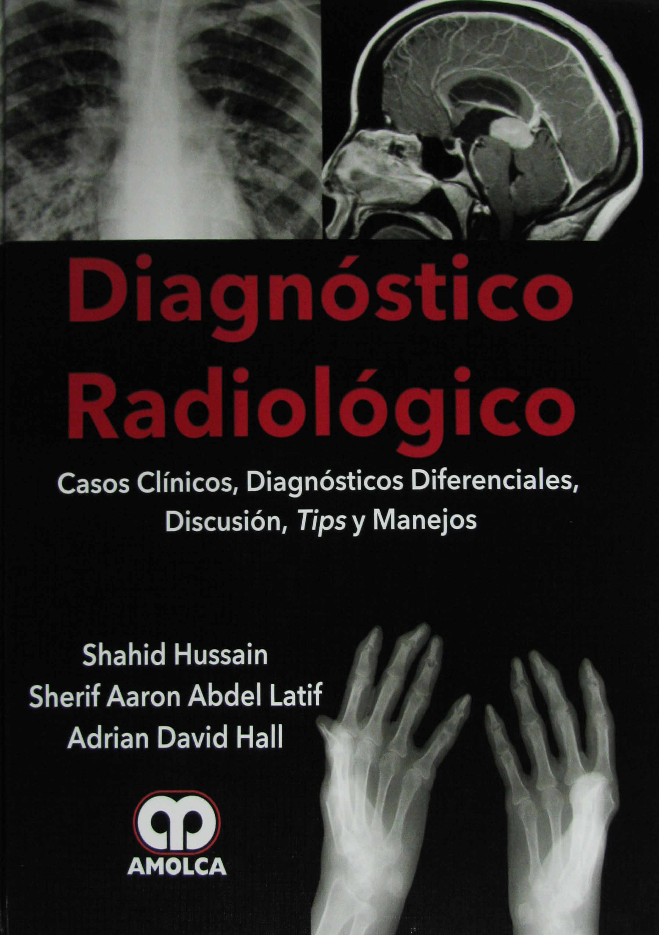 DIAGNÓSTICO RADIÓLOGICO