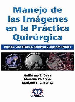 Manejo de las Imágenes en la Práctica Quirúrgica. Hígado, Vías Biliares, Páncreas y Órganos Sólidos
