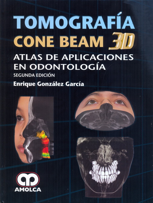 Tomografía Cone Beam 3D