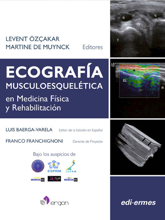 Ecografía musculoesquelética en medicina física y rehabilitación