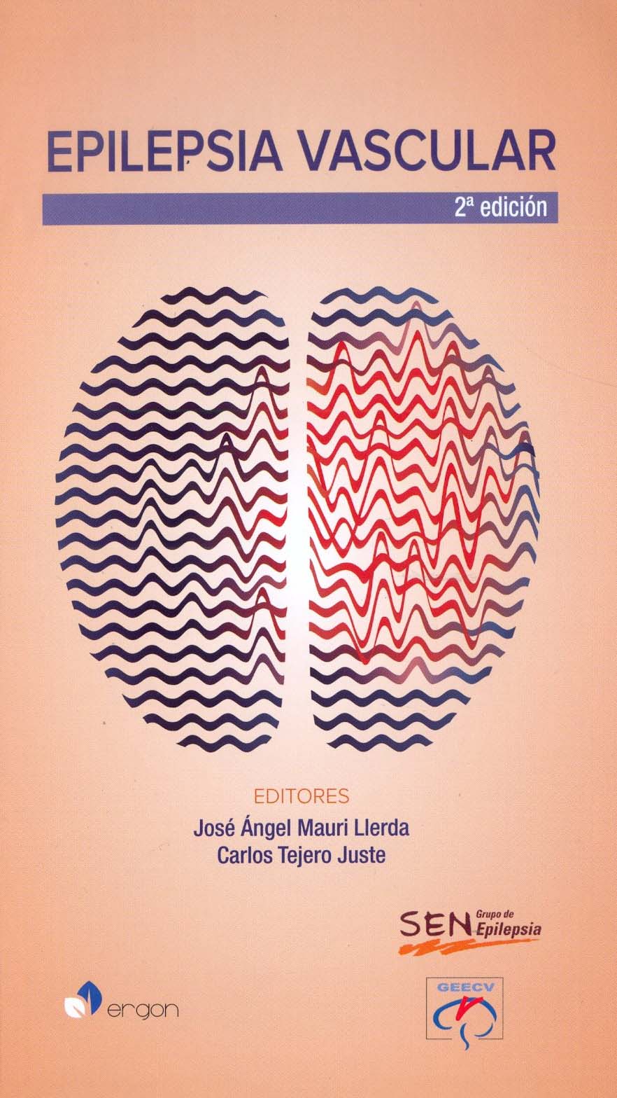 Epilepsia vascular (2ª Edición)