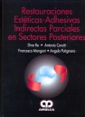 RESTAURACIONES ESTETICAS-ADHESIVAS INDIRECTAS PARCIALES EN SECTORES POSTERIORES