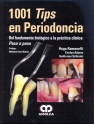 1001 TIPS EN PERIODONCIA