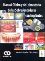 MANUAL CLINICO Y DE LABORATORIO DE LAS SOBREDENTADURAS CON IMPLANTES