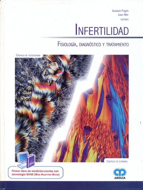 INFERTILIDAD