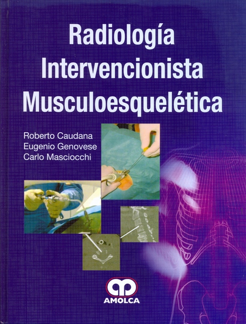 RADIOLOGIA INTERVENCIONISTA MUSCULOESQUELETICA