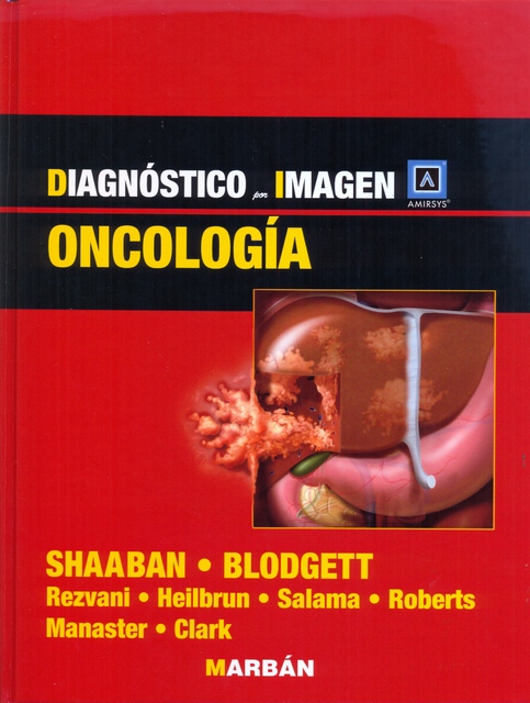 DI ONCOLOGÍA DIAGNÓSTICO POR IMAGEN