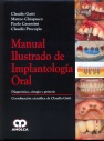 MANUAL ILUSTRADO DE IMPLANTOLOGIA ORAL