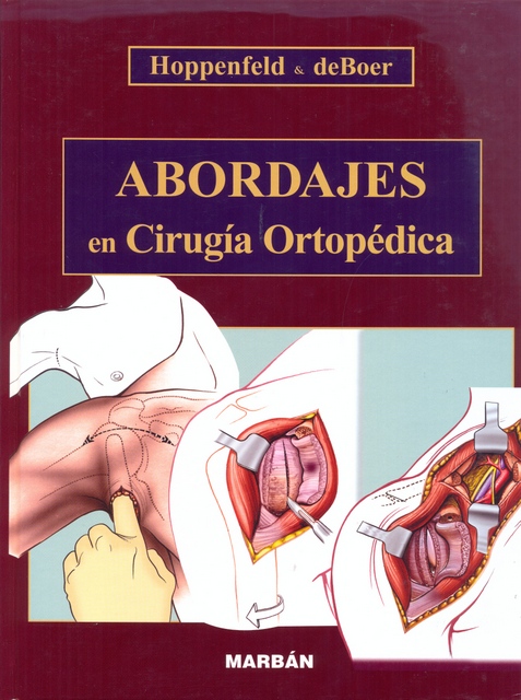 ABORDAJES EN CIRUGIA ORTOPEDICA