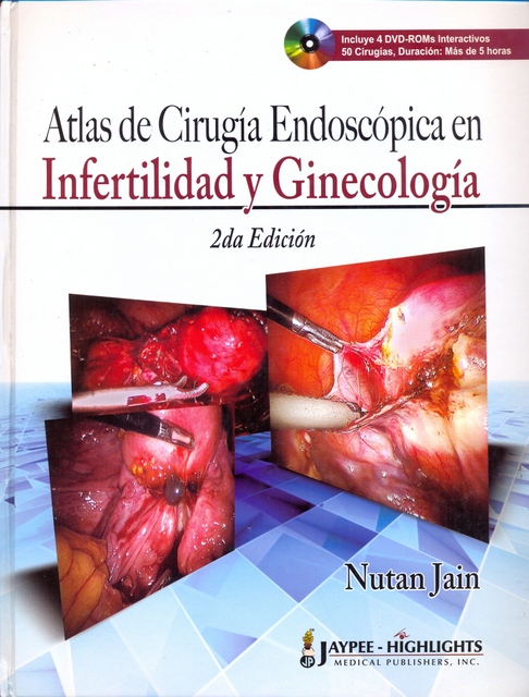 ATLAS DE CIRUGÍA ENDOSCÓPICA EN INFERTILIDAD Y GINECOLOGÍA
