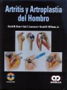 ARTRITIS Y ARTROPLASTIA DEL HOMBRO