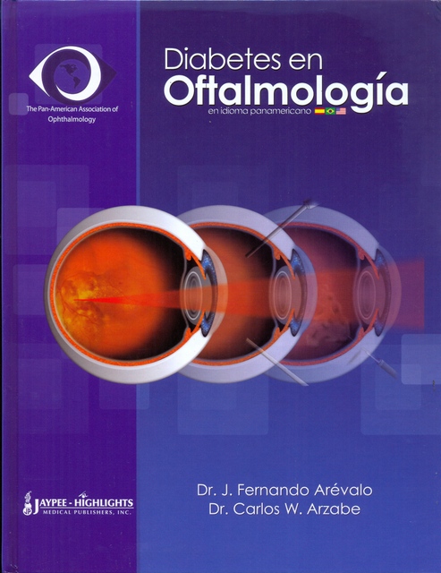 DIABETES EN OFTALMOLOGÍA
