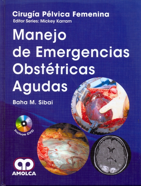 MANEJO DE EMERGENCIAS OBSTÉTRICAS AGUDAS