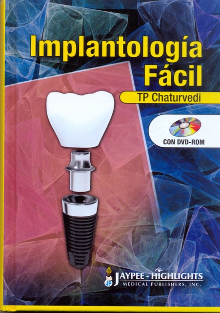 IMPLANTOLOGÍA FÁCIL