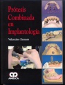 PROTESIS COMBINADA EN IMPLANTOLOGIA