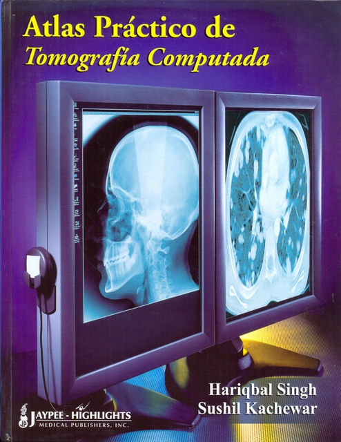 ATLAS PRÁCTICO DE TOMOGRAFÍA COMPUTADA