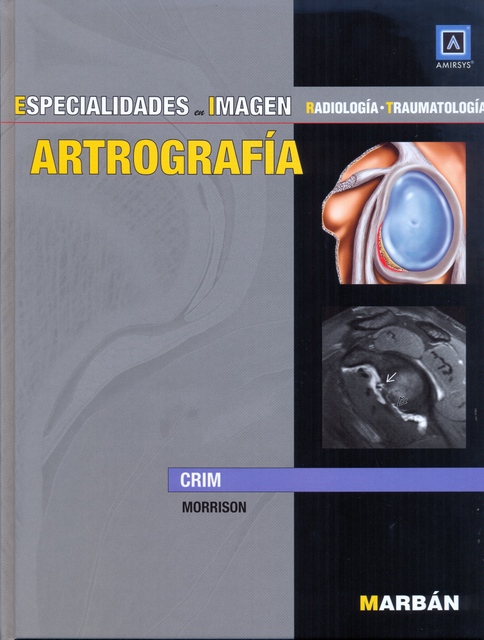 ARTROGRAFÍA. ESPECIALIDADES EN IMAGEN - OFERTA